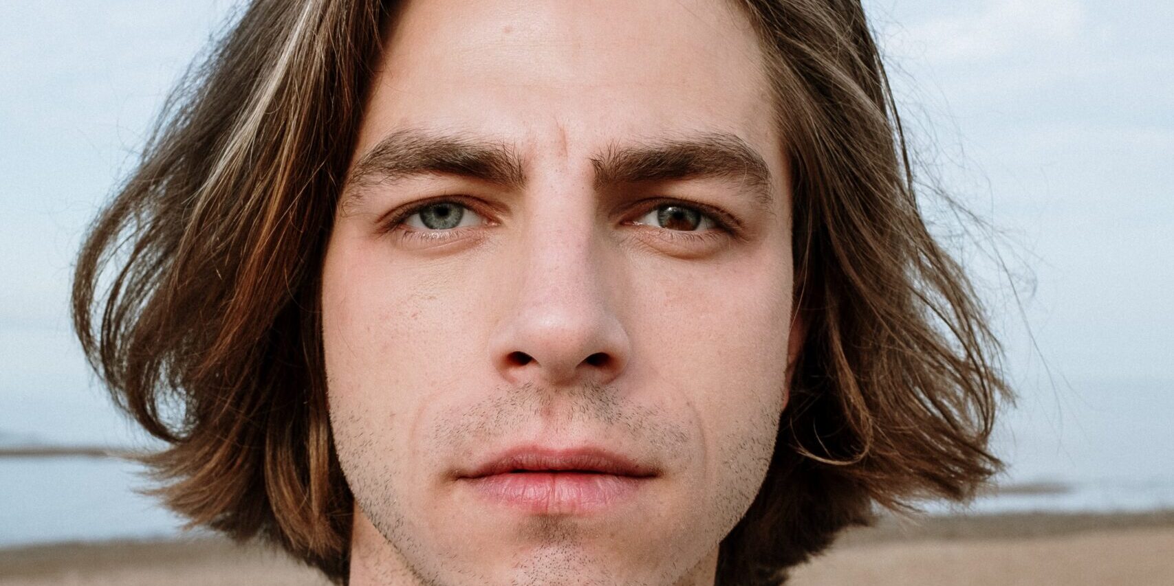 blog heterocromia