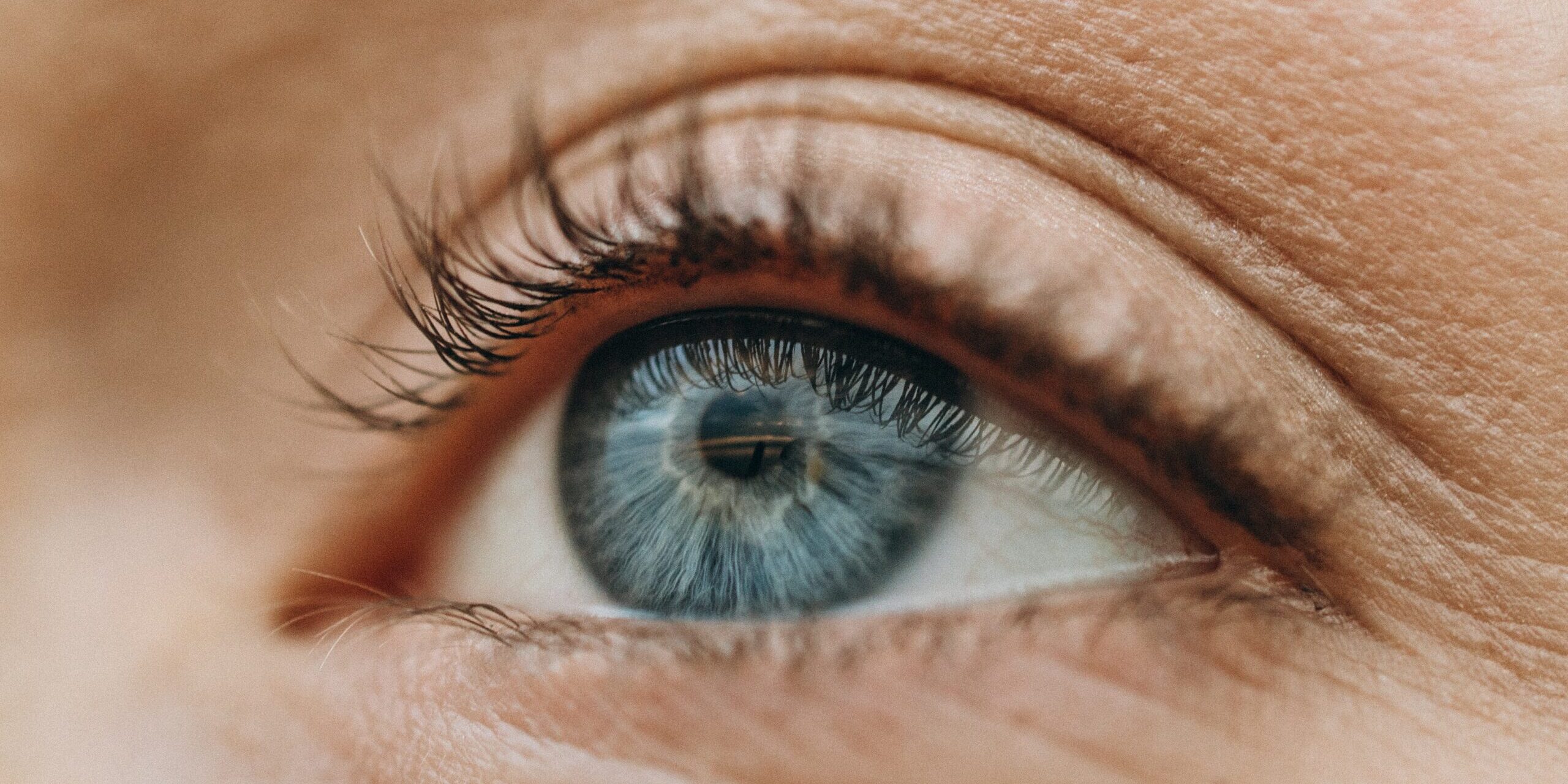 blog ojeras
